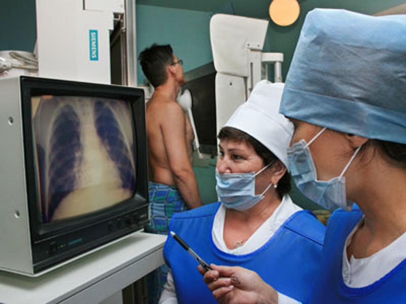 На Чернігівщині збільшилась смертність від туберкульозу 