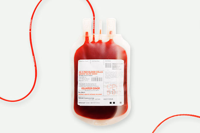 На чернігівську станцію переливання крові очікує низка новацій