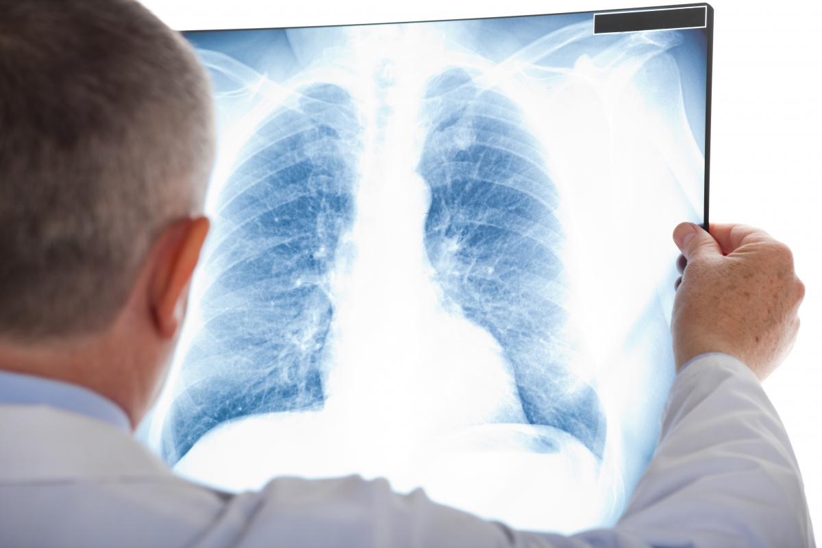 Стан захворюваності на туберкульоз в області викликає неабияке занепокоєння