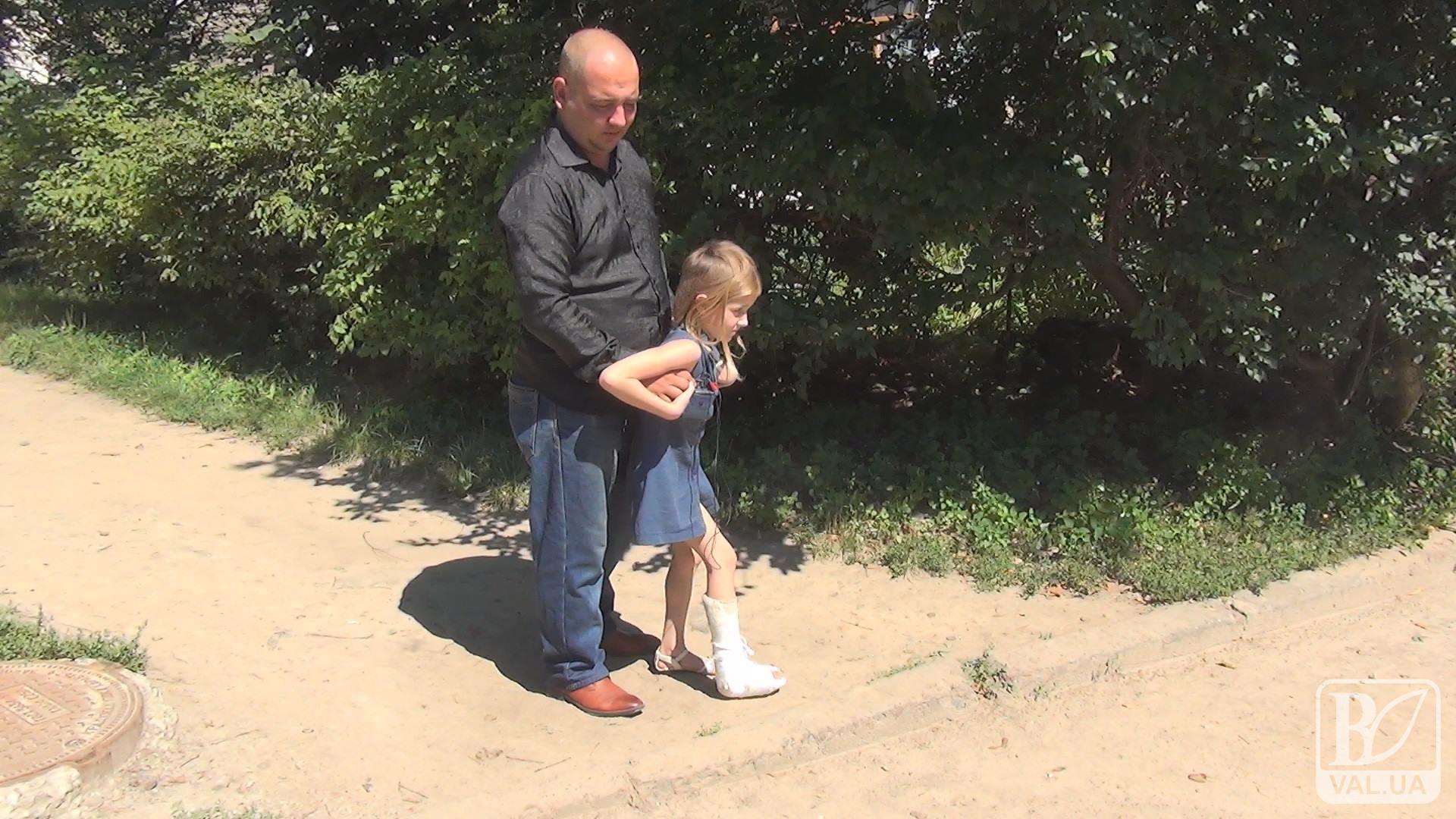 Нога в гипсе – 8-летняя девочка пострадала от КАМАЗа черниговского водоканала. ВИДЕО
