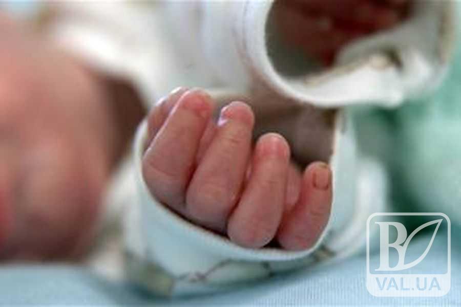 В Чернигове младенец из-за падения с дивана попал в реанимацию