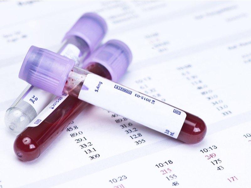 Як розшифрувати загальний аналіз крові?