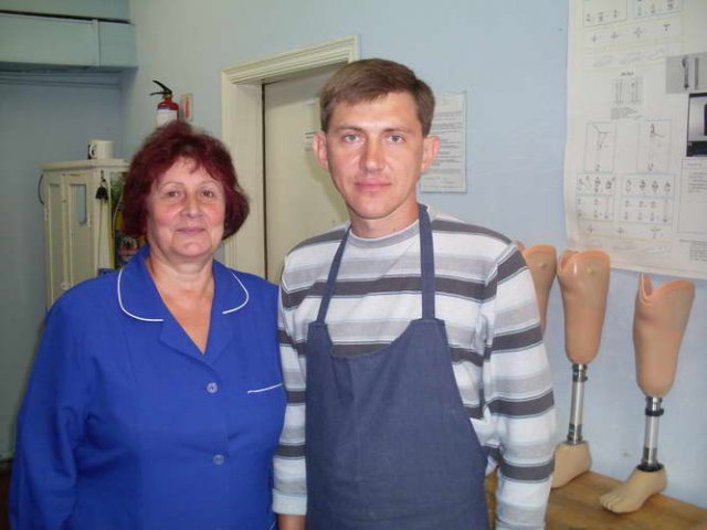 Чернігівський протезний цех працює за німецькими технологіями 