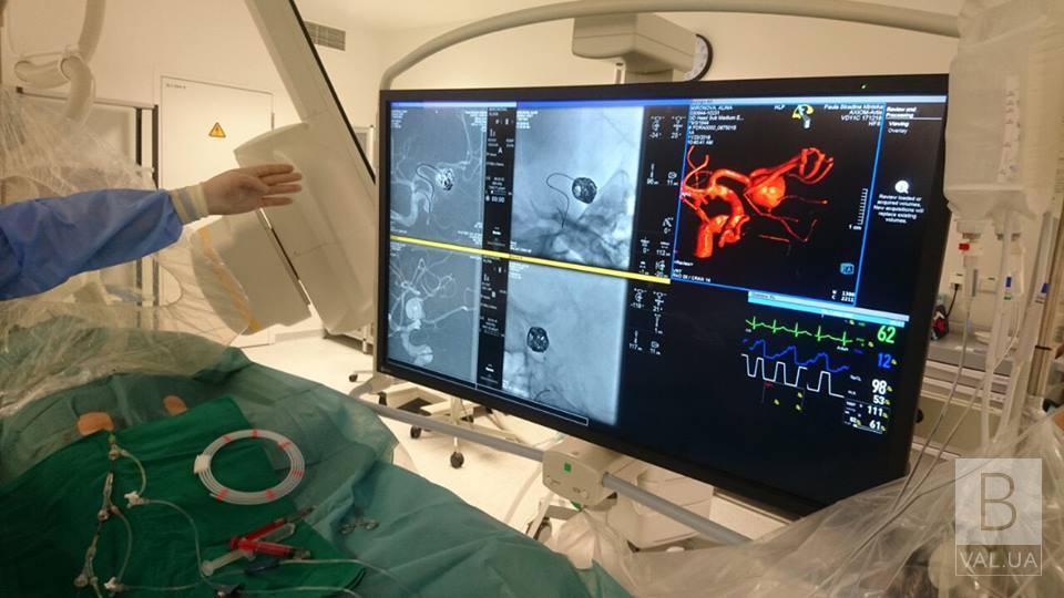Чернігівські лікарі за кордоном опановують нову методику в лікуванні ішемічного інсульту. ФОТО