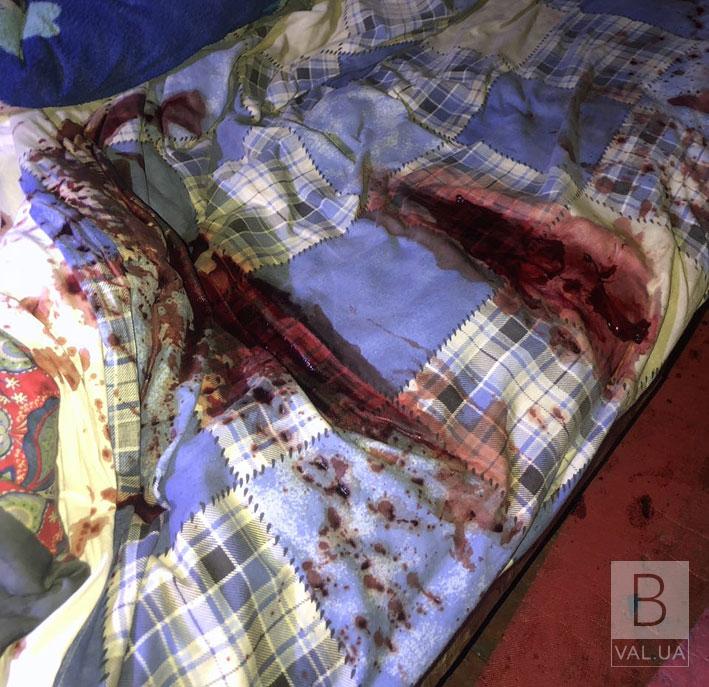 На Черниговщине неадекватный мужчина устроил кровавую расправу над соседями: есть жертва. ФОТО