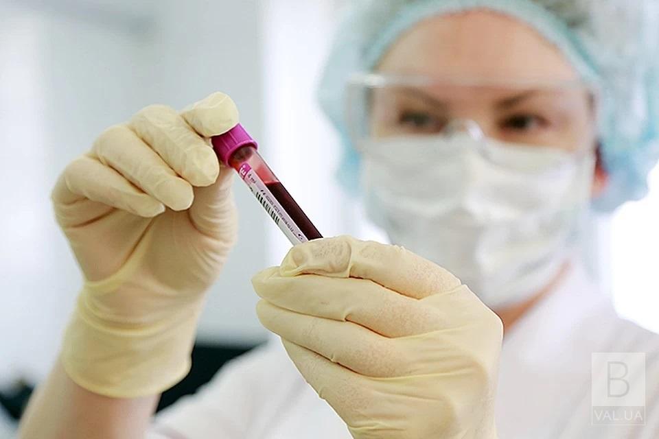 Теоретически готовы, практически — нет: начальник Управления здравоохранения о противостоянии коронавирусу в Чернигове