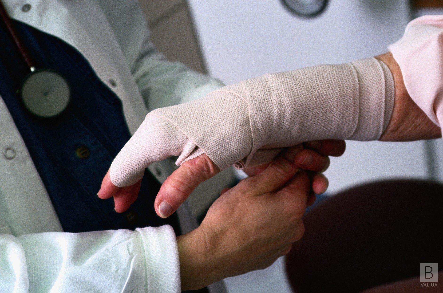 На Куликівщині горіла лазня: 29-річний чоловік отримав опіки 40% тіла
