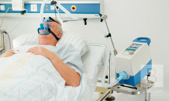 Міська влада Чернігова просить великий бізнес купити апарати штучної вентиляції легень 