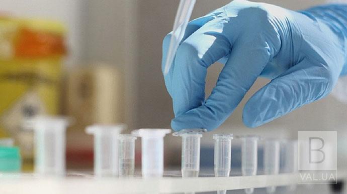 1 випадок за добу: на COVID-19 захворів чоловік з Куликівщини