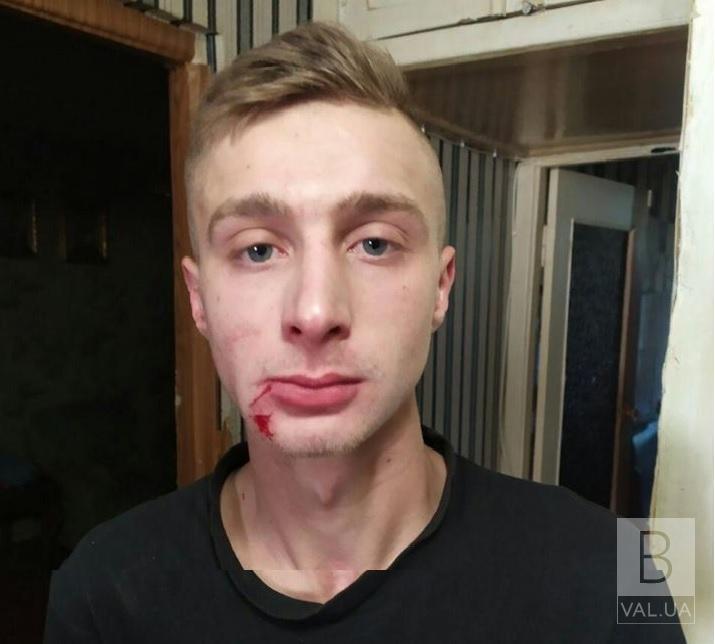 На Чернігівщині розшукується 21-річний хлопець за підозрою у вчиненні зґвалтування