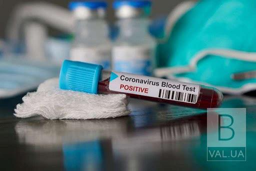 Вже 150: кількість хворих на коронавірус на Чернігівщині продовжує зростати