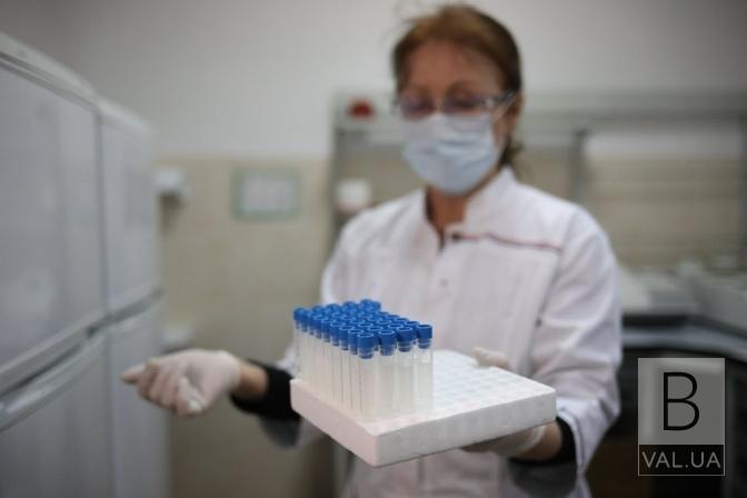 Коронавірус на Чернігівщині: за добу захворіли 94 людини, 45 - одужали