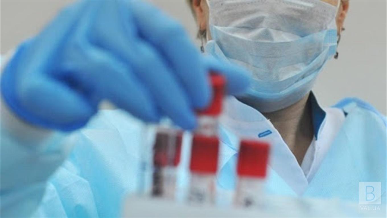 Коронавірус на Чернігівщині: за добу захворіли 96 людей, 75 — вилікувались, померли - двоє