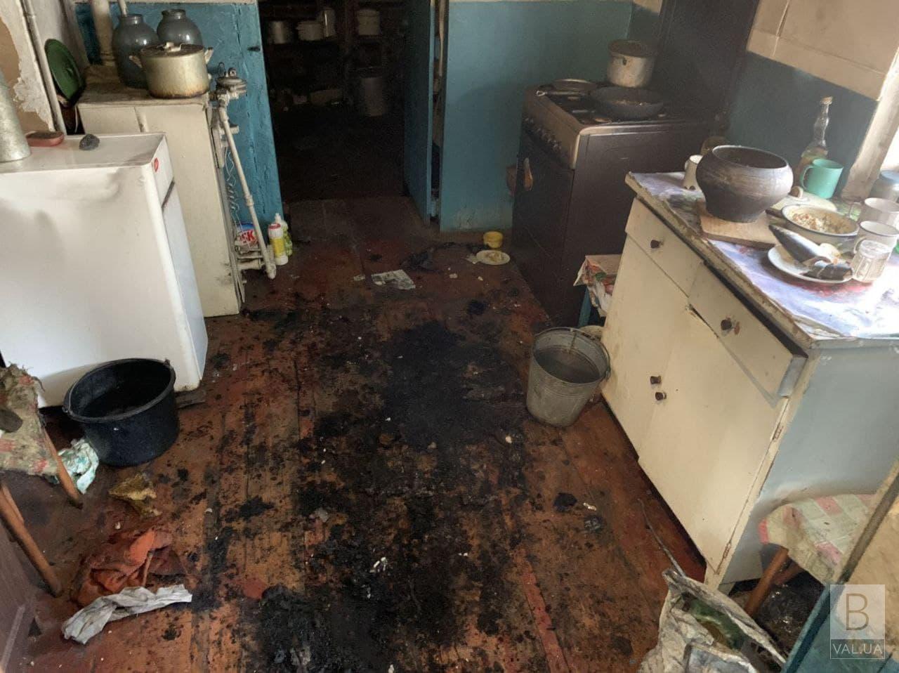 Підкурив: у Чернігівському районі мати та син отримали опіки під час пожежі будинку