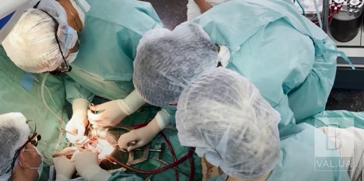 Зупинили серце на годину: у Чернігові пацієнтці зробили операцію на серці за новою методикою