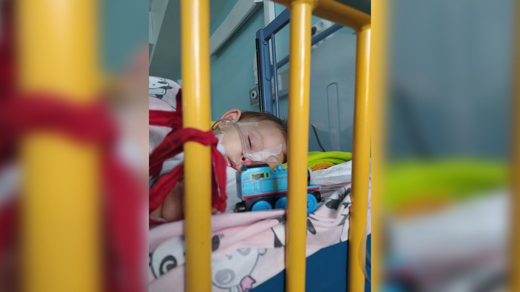 Дворічному хлопчику, що травмувався внаслідок вибуху на Валу у Чернігові, зробили першу операцію в Австрії